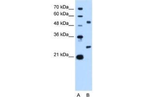 Western Blotting (WB) image for anti-BCL2-Like 1 (BCL2L1) antibody (ABIN2460189) (BCL2L1 anticorps)