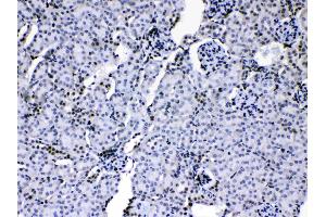 HnRNP A1 was detected in paraffin-embedded sections of mouse kidney tissues using rabbit anti- HnRNP A1 Antigen Affinity purified polyclonal antibody (Catalog # ) at 1 µg/mL.