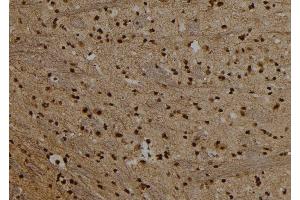 ABIN6279684 at 1/100 staining Rat brain tissue by IHC-P. (PRDM10 anticorps  (C-Term))