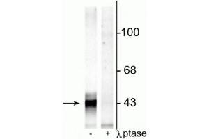 Western blot of rat hippocampal lysate showing specific immunolabeling of the ~43 kDa connexin43 phosphorylated at Ser368 in the first lane (-). (Connexin 43/GJA1 anticorps  (pSer368))
