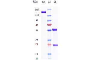 Anti-IL-2Ra / CD25 Reference Antibody (daclizumab) on SDS-PAGE under reducing (R) condition. (Recombinant IL2RA (Daclizumab Biosimilar) anticorps)