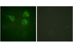 Immunofluorescence analysis of HuvEc cells, using CDC25B (Ab-323) Antibody. (CDC25B anticorps  (AA 289-338))