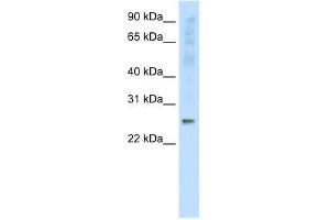 Western Blot showing SNAP25 antibody used at a concentration of 1-2 ug/ml to detect its target protein. (SNAP25 anticorps  (C-Term))