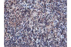 Image no. 8 for anti-V-Akt Murine Thymoma Viral Oncogene Homolog 1 (AKT1) antibody (ABIN1496557) (AKT1 anticorps)