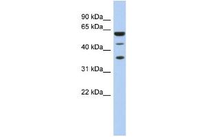 WB Suggested Anti-RDBP Antibody Titration:  0.