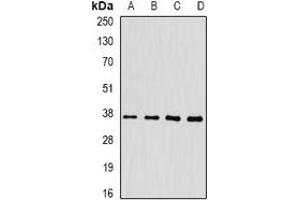 Western blot analysis of FKBP6 expression in HepG2 (A), mouse heart (B), mouse liver (C), rat testis (D) whole cell lysates. (FKBP6 anticorps)