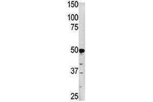 Western blot analysis of PGK2 in HepG2 lysate.