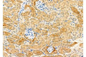 ABIN6265115 and ABIN6276896 at 1/100 staining Mouse kidney tissue by IHC-P.