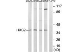 Western Blotting (WB) image for anti-Homeobox B2 (HOXB2) (AA 41-90) antibody (ABIN2890381) (HOXB2 anticorps  (AA 41-90))