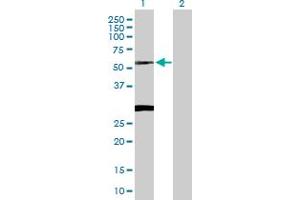 Western Blot analysis of CLN3 expression in transfected 293T cell line by CLN3 MaxPab polyclonal antibody. (CLN3 anticorps  (AA 1-438))