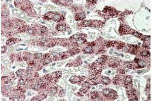Immunohistochemistry (Paraffin-embedded Sections) (IHC (p)) image for anti-Sterol Carrier Protein 2 (SCP2) (Internal Region) antibody (ABIN1108955) (SCP2 anticorps  (Internal Region))