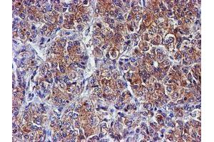 Image no. 5 for anti-Spermine Synthase, SMS (SMS) antibody (ABIN1501093)