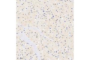 Immunohistochemistry of paraffin embedded rat heart using HDAC (ABIN7074234) at dilution of 1:1200 (300x lens) (HDAC11 anticorps)