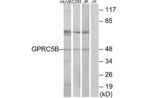 Western blot analysis of extracts from HUVEC cells, 293cells and Jurkat cells, using GPRC5B antibody. (GPRC5B anticorps  (Internal Region))