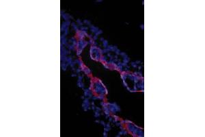 Image no. 1 for anti-Transforming Growth Factor, beta Receptor III (TGFBR3) (Extracellular Domain) antibody (ABIN265019) (TGFBR3 anticorps  (Extracellular Domain))