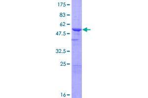 Image no. 1 for Biphenyl Hydrolase-Like (Serine Hydrolase) (BPHL) (AA 1-274) protein (GST tag) (ABIN1346831)