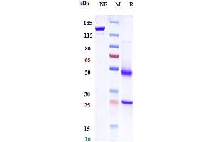 Anti-GPR49 / LGR5 Reference Antibody (BNC101) on SDS-PAGE under reducing (R) condition.