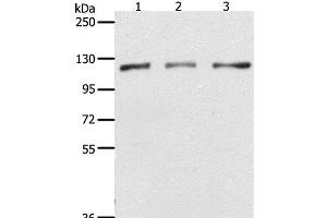 Western Blot analysis of Hela, K562 and Jurkat cell using PARP1 Polyclonal Antibody at dilution of 1:350