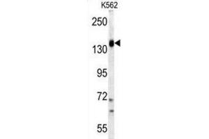 Western Blotting (WB) image for anti-Phosphoinositide-3-Kinase, Catalytic, gamma Polypeptide (PIK3CG) antibody (ABIN3003633)