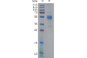 Human T Protein, hFc Tag on SDS-PAGE under reducing condition.