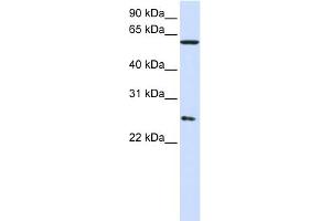 WB Suggested Anti-CCT7 Antibody Titration: 0. (CCT7 anticorps  (Middle Region))