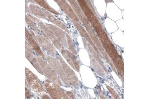 Immunohistochemical staining (Formalin-fixed paraffin-embedded sections) of human skeletal muscle with PGM1 monoclonal antibody, clone CL3299  shows moderate cytoplasmic immunoreactivity in muscle fibers. (Phosphoglucomutase 1 anticorps)
