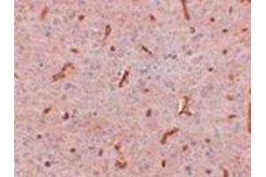 Immunohistochemistry of TWA1 in rat brain tissue with this product at 2. (GID8/C20orf11 anticorps  (C-Term))