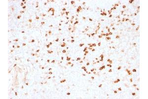 Formalin-fixed, paraffin-embedded human Tonsil stained with Lambda Light Chain Monoclonal Antibody (N10/2). (IgL anticorps)