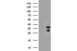 Western Blotting (WB) image for anti-Hes Family bHLH Transcription Factor 1 (HES1) antibody (ABIN1498633)