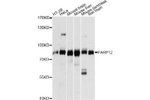 Western blot analysis of extracts of various cell lines, using PARP12 antibody. (PARP12 anticorps)