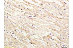 Formalin-fixed and paraffin embedded rat heart tissue labeled with Anti-phospho-ASK1(Thr845) Polyclonal Antibody, Unconjugated  at 1:200 followed by conjugation to the secondary antibody, (SP-0023), and DAB staining