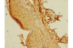 Immunohistochemistry of paraffin-embedded human skin tissue using ABIN7174896 at dilution of 1:100 (C8orf34 anticorps  (AA 1-300))