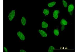 Immunofluorescence of monoclonal antibody to MXI1 on HeLa cell.