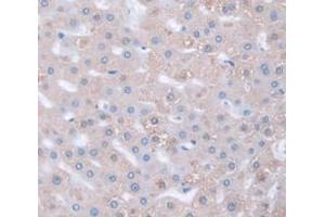 IHC-P analysis of Human Tissue, with DAB staining. (HSPG2 anticorps  (AA 4149-4391))
