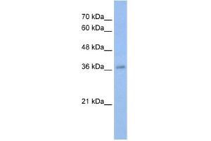 WB Suggested Anti-MYB Antibody Titration:  0. (MYB anticorps  (N-Term))