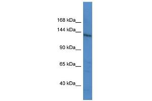 WB Suggested Anti-LTBP1 Antibody Titration: 0. (LTBP1 anticorps  (C-Term))