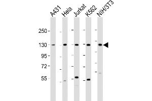 All lanes : Anti-DDX42 Antibody (N-Term) at 1:2000 dilution Lane 1: A431 whole cell lysate Lane 2: Hela whole cell lysate Lane 3: Jurkat whole cell lysate Lane 4: K562 whole cell lysate Lane 5: NIH/3T3 whole cell lysate Lysates/proteins at 20 μg per lane. (DDX42 anticorps  (AA 104-138))