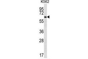 ZNF623 Antibody (C-term) western blot analysis in K562 cell line lysates (35 µg/lane).