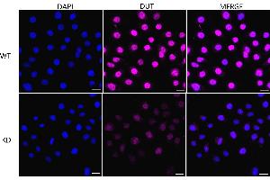 Immunocytochemical staining of HeLa cells using DUT antibody (ABIN7798312), 1:1,000), Top panel: wild-type (WT), Bottom panal: DUT shRNA knockdown (KD).