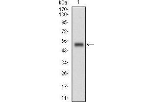 Western blot analysis using RANGAP1 mAb against human RANGAP1 (AA: 359-587) recombinant protein.