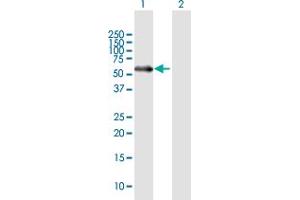 Western Blot analysis of MATN1 expression in transfected 293T cell line by MATN1 MaxPab polyclonal antibody. (MATN1 anticorps  (AA 1-496))