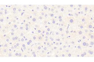 Detection of LIPC in Mouse Liver Tissue using Polyclonal Antibody to Lipase, Hepatic (LIPC)