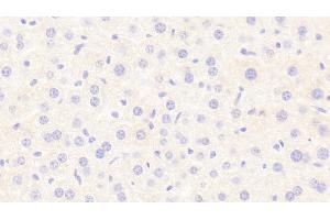 Detection of LIPC in Mouse Liver Tissue using Polyclonal Antibody to Lipase, Hepatic (LIPC) (LIPC anticorps  (AA 159-415))