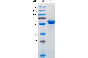 SARS-CoV-2 (2019-nCoV) S protein RBD(L452R& E484Q), hFc Tag on SDS-PAGE under reducing condition.