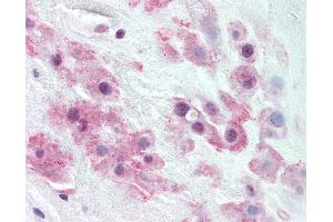 Anti-TJP2 / ZO-2 antibody IHC of human placenta, intermediate trophoblasts.