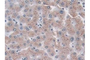 Detection of TPP1 in Human Liver Tissue using Polyclonal Antibody to Tripeptidyl Peptidase I (TPP1)