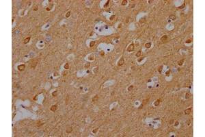 IHC image of ABIN7146440 diluted at 1:200 and staining in paraffin-embedded human brain tissue performed on a Leica BondTM system.