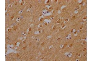 IHC image of ABIN7146440 diluted at 1:200 and staining in paraffin-embedded human brain tissue performed on a Leica BondTM system. (CAMK2A anticorps  (AA 321-478))
