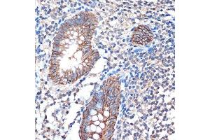 Immunohistochemistry of paraffin-embedded human appendix using LI Cadherin/Cadherin-17 Rabbit mAb (ABIN7268249) at dilution of 1:100 (40x lens).