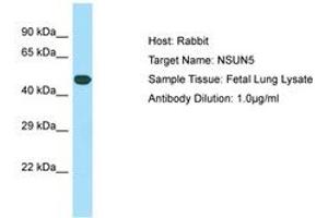 Image no. 1 for anti-NOP2/Sun Domain Family, Member 5 (NSUN5) (C-Term) antibody (ABIN6749897) (NSUN5 anticorps  (C-Term))